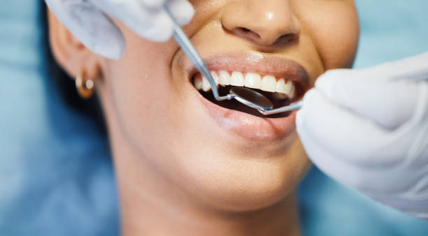 Best Emergency Treatment for Oral Infections in Lakewood, OH